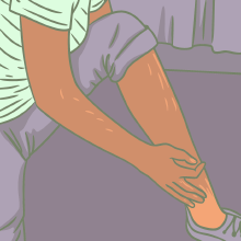 Featured image of post Симптомы